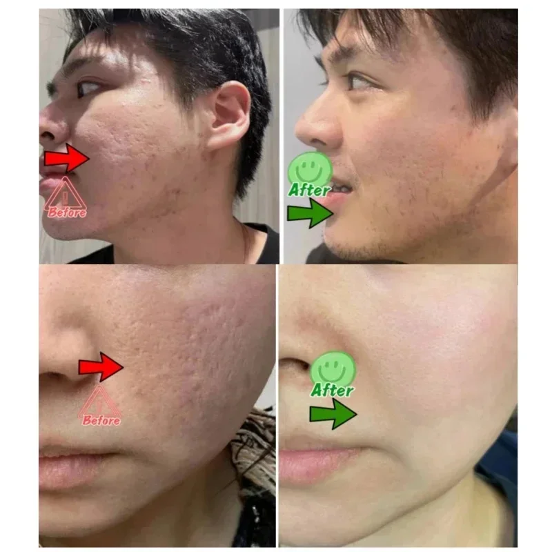 Salicylic Acid Pore Clearing C - đánh giá và giá Korean Lifestyle Products