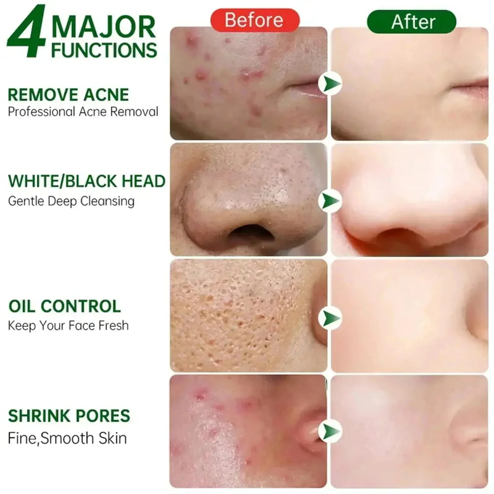 Salicylic Acid Pore Clearing C - đánh giá và giá Korean Lifestyle Products