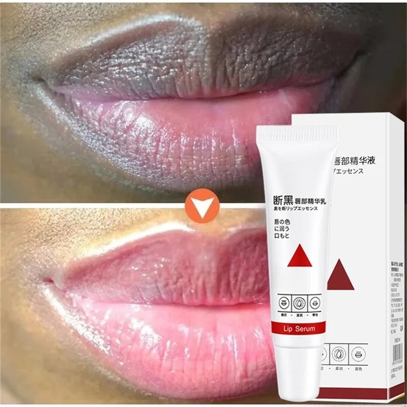 Remove Dark Lip Balm Fast Ligh - đánh giá và giá Korean Lifestyle Products