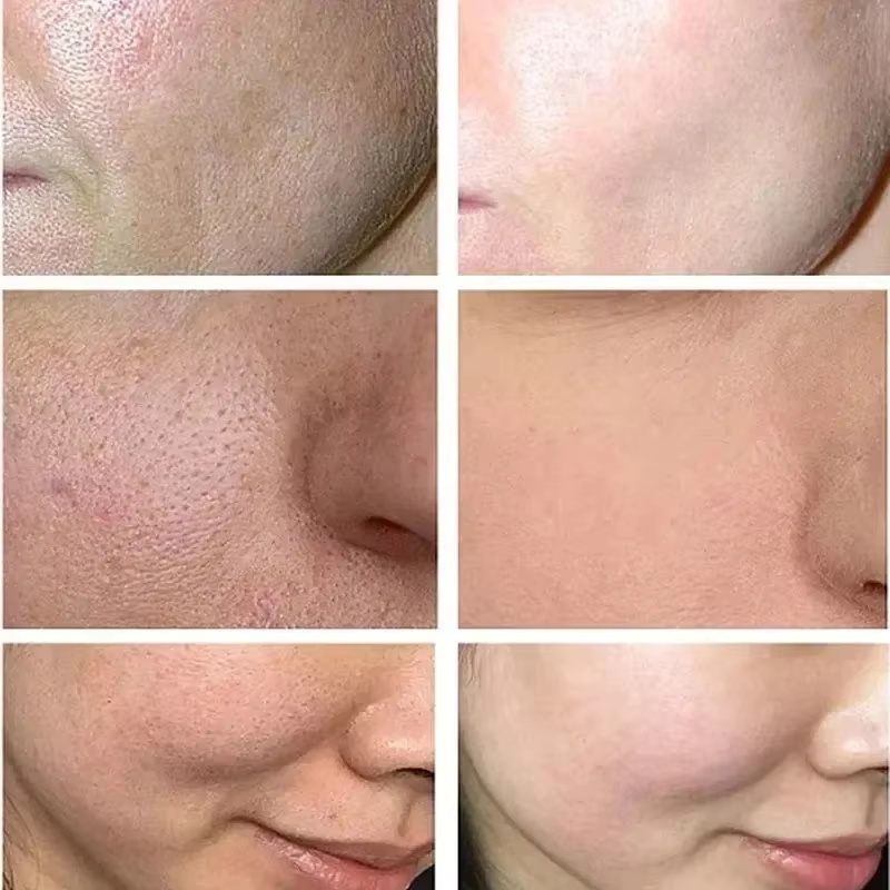 Salicylic Acid Pore Shrinking  - đánh giá và giá Korean Lifestyle Products